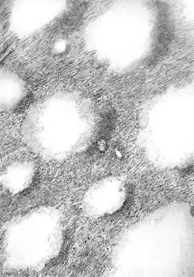 ������� ��� ������ - ��� ���, ���������?�