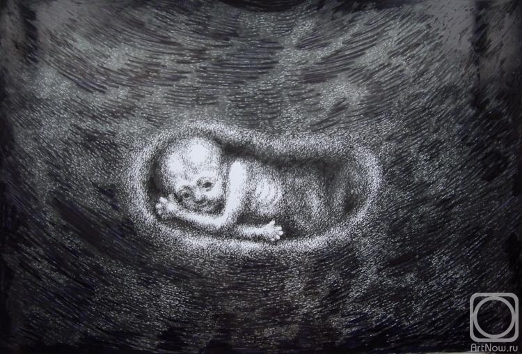 Yaguzhinskaya Anna. Three-month-old man in the womb, on an ultrasound monitor