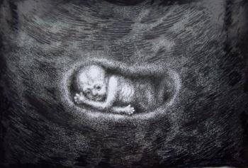 Three-month-old man in the womb, on an ultrasound monitor. Yaguzhinskaya Anna