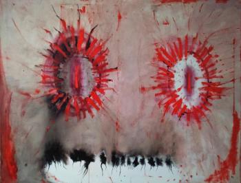 Infection. Perez Ruslan